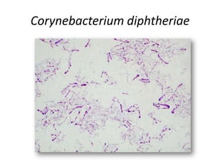 Corynebacterium diphtheriae
 