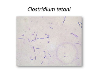 Clostridium tetani
 
