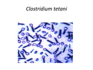 Clostridium tetani
 