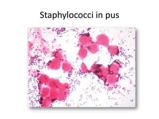Staphylococci in pus
 