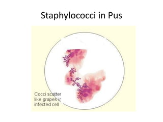 Staphylococci in Pus
 