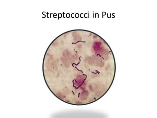 Streptococci in Pus
 