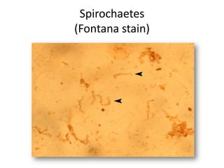 Spirochaetes
(Fontana stain)
 