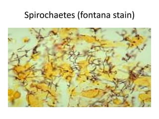 Spirochaetes (fontana stain)
 