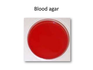 Blood agar
 