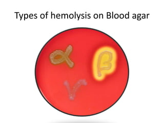 Types of hemolysis on Blood agar
 