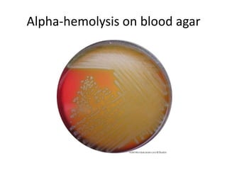 Alpha-hemolysis on blood agar
 