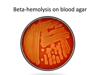 Beta-hemolysis on blood agar
 