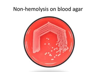 Non-hemolysis on blood agar
 