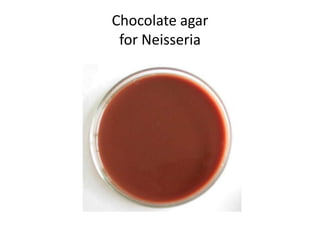 Chocolate agar
for Neisseria
 
