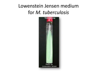 Lowenstein Jensen medium
for M. tuberculosis
 