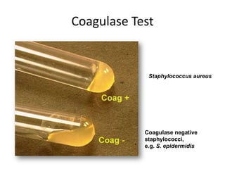 Coagulase Test
Staphylococcus aureus
Coagulase negative
staphylococci,
e.g. S. epidermidis
 