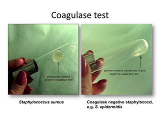 Coagulase test
Staphylococcus aureus Coagulase negative staphylococci,
e.g. S. epidermidis
 