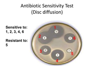 Antibiotic Sensitivity Test
(Disc diffusion)
Sensitive to:
1, 2, 3, 4, 6
Resistant to:
5
1
5
62
4
3
 