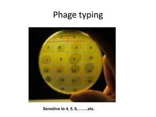 Phage typing
1 2
3 4 5 6
7 8 9 10
11 12 13 14
15 16 17 18
19 20
Sensitive to 4, 5, 6,……..etc.
 