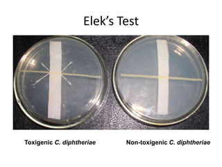 Elek’s Test
Toxigenic C. diphtheriae Non-toxigenic C. diphtheriae
 