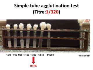 Simple tube agglutination test
(Titre:1/320)
TITRE
1/20 1/40 1/80 1/160 1/320 1/640 1/1280 - ve control
 