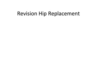 Revision Hip Replacement
 