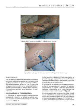 otros fármacos, etc.
Esta situación nos debe hacer reﬂexionar y considerar
extender el uso de la vía subcutánea a otros procesos
agudos y crónicos en los que el paciente pueda bene-
ﬁciarse de las ventajas de esta vía, y en los que quizá
no hayamos contemplado nunca esta posibilidad (por
ejemplo, ¿cuántas veces se “pincha una Buscapina®
”
intramuscular y se podría haber puesto por vía sub-
cutánea?).
COLOCACIÓN DE LA VÍA SUBCUTÁNEA
La colocación se realiza utilizando una palomilla de
calibre 21G ó 23G. En su defecto es posible utili-
zar un catéter de teﬂón (Abbocath®
) de calibre 18
3,4,5,8,9,10,11,12,13
(ﬁgura 1).
Previo lavado de manos y colocación de guantes, se
procede a purgar la palomilla con suero ﬁsiológico
(aproximadamente 0.5 ml) o directamente con la me-
dicación que vamos a administrar.
A continuación, se desinfecta con povidona yodada11
o alcohol9
la zona de punción, que debe ser una zona
de piel limpia, sin heridas y sin vello (generalmente
deltoides, infraclavicular, y en menor medida cua-
drantes superiores abdominales)9,11,13
(ﬁgura 2).
Previamente pellizcada la piel para identiﬁcar el tejido
celular subcutáneo, se coloca la palomilla incidiendo
con un ángulo de 45º sobre la piel y se coloca encima
un apósito transparente (Tegaderm®
, Hydroﬁlm®
)9,11,13
que nos permitirá observar si existen complicaciones
R E V I S I Ó N D E G U Í A S C L Í N I C A S
Utilización de la Vía Subcutánea... Soriano H., et al.
430REV CLÍN MED FAM 2009; 2 (8):426-433
Figura 3. Punción de palomilla subcutánea (Fotografía: Lourdes Rodenas).
Figura 4. Apósito transparente sobre palomilla colocada (Fotografía: Lourdes Rodenas).
 