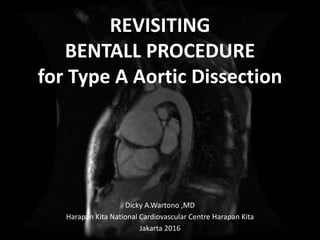 REVISITING
BENTALL PROCEDURE
for Type A Aortic Dissection
Dicky A.Wartono ,MD
Harapan Kita National Cardiovascular Centre Harapan Kita
Jakarta 2016
 