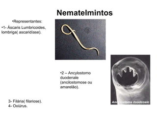 Nematelmintos 1- Áscaris Lumbricoides, lombriga( ascaridíase). 2 – Ancylostomo duodenale (ancilostomose ou amarelão). 3- Filária( filariose). 4- Oxiúrus. Representantes: 