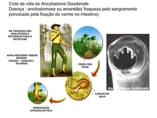 Ciclo de vida do Ancylostomo Duodenale Doença : ancilostomose ou amarelão( fraqueza pelo sangramento provocado pela fixação do verme no intestino). 