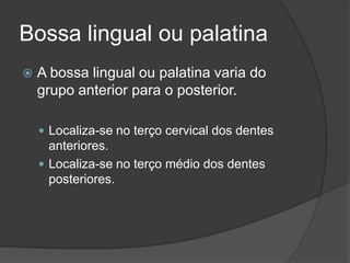 Bossa lingual ou palatina
   A bossa lingual ou palatina varia do
    grupo anterior para o posterior.

     Localiza-se no terço cervical dos dentes
      anteriores.
     Localiza-se no terço médio dos dentes
      posteriores.
 