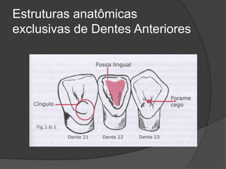 Estruturas anatômicas
exclusivas de Dentes Anteriores
 