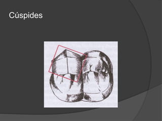 Cúspides
 