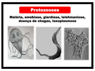 Protozooses
Malária, amebíase, giardíase, leishmaniose,
doença de chagas, toxoplasmose
 