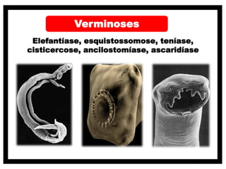 Verminoses
Elefantíase, esquistossomose, teníase,
cisticercose, ancilostomíase, ascaridíase
 
