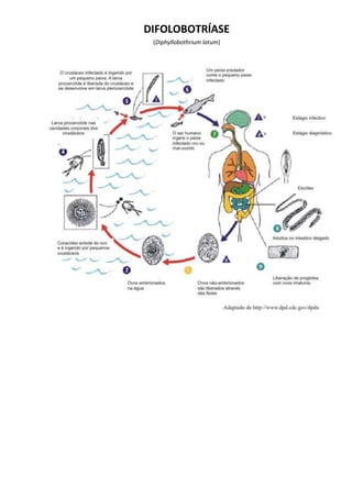 DIFOLOBOTRÍASE
(Diphyllobothrium latum)
 