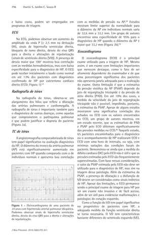 796       Hoette S, Jardim C, Souza R




e baixo custo, podem ser empregados em                    com as medidas de pressão na AP.(4) Estudos
programas de triagem.                                     mostram limite superior da normalidade para
                                                          o diâmetro da AP em indivíduos normais varia
ECG                                                       de 32,6 mm a 33,2 mm. Um grupo de autores
                                                          encontrou uma especificidade de 95% para o
    No ECG, podemos observar um aumento da
                                                          diagnóstico de HP quando o diâmetro da AP é
amplitude da onda P (≥ 2,5 mm na derivação
                                                          maior que 33,2 mm (Figura 2b).(5)
DII), sinais de hipertrofia ventricular direita,
bloqueio de ramo direito, desvio do eixo QRS              Ecocardiograma
para a direita e alterações de repolarização
(strain de ventrículo direito [VD]). A presença de            O ecocardiograma (ECO) é o principal
desvio maior que 100° mostrou boa correlação              exame utilizado para a triagem de HP. Mesmo
com as medidas hemodinâmicas, mas com baixa               assim, é um exame com limitações importantes
especificidade para o diagnóstico de HP. O ECG            que merecem destaque, como o fato de ser
pode receber inicialmente o laudo como normal             altamente dependente do examinador e de que
em até 13% dos pacientes com diagnóstico                  uma porcentagem significativa dos pacientes
confirmado de HP por cateterismo cardíaco                 não apresenta janela adequada para a realização
direito (CCD; Figura 1).(3)                               do exame. Outra limitação é que a estimativa
                                                          da pressão sistólica da AP (PSAP) depende do
Radiografia de tórax                                      jato de regurgitação tricúspide e da pressão de
                                                          átrio direito (PAD). Em até 10% dos casos, a
    Na radiografia do tórax, observa-se um
                                                          medida da velocidade do jato de regurgitação
alargamento dos hilos que reflete a dilatação
                                                          tricúspide não é possível, impedindo, portanto,
das artérias pulmonares e cardiomegalia. A
                                                          a estimativa da PSAP. Apesar de alguns estudos
radiografia de tórax é importante também para
                                                          mostrarem uma significativa correlação dos
o diagnóstico de outras doenças, como aquelas
                                                          achados no ECO com os valores encontrados
que comprometem o parênquima pulmonar
                                                          no CCD, um grupo de autores mostrou, em
e que podem justificar a dispneia do paciente
                                                          um estudo recente, que as estimativas de PAD
(Figura 2a).
                                                          e PSAP pelo ECO diferiram significativamente
TC de tórax                                               das pressões medidas no CCD.(6) Naquele estudo,
                                                          65 pacientes encaminhados para o diagnóstico
   A angiotomografia computadorizada de tórax             ou o acompanhamento de HP realizaram ECO e
tem papel significativo na avaliação diagnóstica          CCD com uma hora de intervalo, ou seja, com
da HP. O diâmetro do tronco da artéria pulmonar           mínimas variações das condições basais do
(AP) está significativamente aumentado em                 paciente. Demonstrou-se ainda que a medida do
pacientes com HP quando comparado com o de                débito cardíaco (DC) pelo ECO não é útil e que as
indivíduos normais e apresenta boa correlação             pressões estimadas pelo ECO são frequentemente
                                                          superestimadas. Com base nessas considerações,
                                                          o valor da PSAP estimada pelo ECO não deve ser
                                                          utilizado para o diagnóstico de HP, mas sim na
                                                          triagem dessa patologia. Além da estimativa da
                                                          PSAP, a presença de dilatação e a disfunção de
                                                          VD devem ser consideradas como sinais indiretos
                                                          de HP. Apesar das limitações, o ECO permanece
                                                          sendo o principal exame de triagem para HP por
                                                          ser um exame não invasivo e de fácil acesso,
                                                          além de ser útil para evidenciar malformações e
                                                          patologias do coração esquerdo.
                                                              Como a função do VD tem papel significativo
Figura 1 - Eletrocardiograma de uma paciente de           no prognóstico de pacientes com HP, a
24 anos com hipertensão arterial pulmonar idiopática.     adequada medida da função ventricular direita
Podemos observar sinais de hipertrofia ventricular
                                                          se torna necessária. O VD tem características
direita, desvio do eixo QRS para a direita e alterações
de repolarização.                                         bastante diferentes do ventrículo esquerdo (VE).


J Bras Pneumol. 2010;36(6):795-811
 
