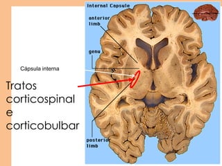 Tratos
corticospinal
e
corticobulbar
Cápsula interna
 