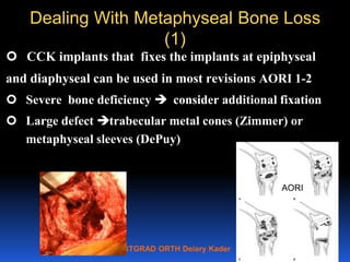 POSTGRAD ORTH Deiary Kader
Dealing With Metaphyseal Bone Loss
(1)
 CCK implants that fixes the implants at epiphyseal
and...