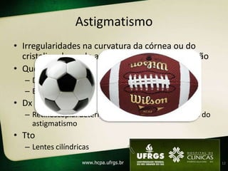 Astigmatismo
• Irregularidades na curvatura da córnea ou do
  cristalino, levando a diferentes graus de refração
• Queixas
   – Dificuldade visão p/ longe e p/ perto
   – Borramento heterogêneo da imagem
• Dx
   – Retinoscopia: determinar os dois eixos meridianos do
     astigmatismo
• Tto
   – Lentes cilíndricas
                                                            12
 
