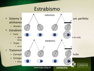 Estrabismo
• Sistema Visual para funcionar bem necessita de um perfeito
  alinhamento (paralelismo ocular)
   – Através de 6 músculos extraoculares
• Estrabismo = desalinhamento dos olhos
   • Foria
       • desvios oculares manifestos apenas em condições de rompimento da visão
         binocular
   • Tropia
       • se manifestam mesmo sem rompimento da visão binocular

• Tratamento
   – Correção óptica adequada, tratar ambliopia, melhorar a fusão
   – Cirúrgico
       • Precoce qndo congênito
 