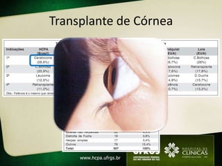 Transplante de Córnea
 