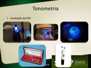 Tonometria
• Avaliação da PIO
 