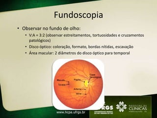 Fundoscopia
• Observar no fundo de olho:
   • V:A = 3:2 (observar estreitamentos, tortuosidades e cruzamentos
     patológicos)
   • Disco óptico: coloração, formato, bordas nítidas, escavação
   • Área macular: 2 diâmetros do disco óptico para temporal
 