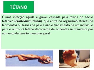 É uma infecção aguda e grave, causada pela toxina do bacilo
tetânico (Clostridium tetani), que entra no organismo através de
ferimentos ou lesões de pele e não é transmitido de um indivíduo
para o outro. O Tétano decorrente de acidentes se manifesta por
aumento da tensão muscular geral.
TÉTANO
 