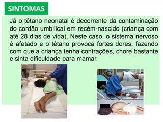 SINTOMAS
Já o tétano neonatal é decorrente da contaminação
do cordão umbilical em recém-nascido (criança com
até 28 dias de vida). Neste caso, o sistema nervoso
é afetado e o tétano provoca fortes dores, fazendo
com que a criança tenha contrações, chore bastante
e sinta dificuldade para mamar.
 