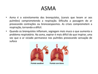 ASMA
• Asma é o estreitamento dos bronquíolos, (canais que levam ar aos
pulmões) comprometendo a respiração. Dificulta a passagem do ar
provocando contrações ou broncoespasmos. As crises comprometem a
respiração, tornando-a difícil.
• Quando os bronquíolos inflamam, segregam mais muco o que aumenta o
problema respiratório. Na asma, expirar é mais difícil do que inspirar, uma
vez que o ar viciado permanece nos pulmões provocando sensação de
sufoco
 