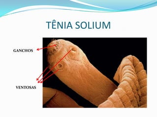 TÊNIA SOLIUM

GANCHOS




VENTOSAS
 