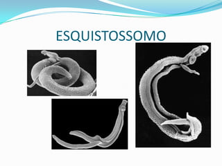 ESQUISTOSSOMO
 