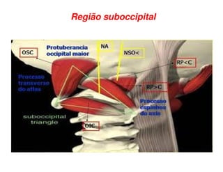 Região suboccipital
 