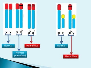 Normal
Normal
(portadora)
Hemofílica Normal
Hemofílico
 