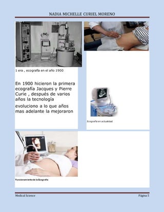 NADIA MICHELLE CURIEL MORENO
Medical Science Página 5
1 era , ecografía en el año 1900
En 1900 hicieron la primera
ecografía Jacques y Pierre
Curie , después de varios
años la tecnología
evoluciono a lo que años
mas adelante la mejoraron
Ecografía en actualidad
Funcionamientode la Ecografía
 