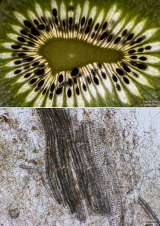 Baga de Kiwi
Rubim Silva
	 Bolor do tomate
Isabel Santos
 