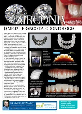 O óxido de zircônia é classificado como um metal
de transição e pertence ao grupo 4 da tabela
periódica. Na sua forma bruta é um metal azul-
escuro, com elevada resistência à tração, alta
dureza e resistência à corrosão. Como possui
características semelhantes ao diamante depois
de processada, é bastante usada para a confecção
de jóias. Na odontologia, o metal bruto é
processado e adquire uma cor branco-amarelada,
tornando-se um material ideal para casos em que
a estética é fator determinante para o sucesso da
restauração. Além de sua alta estética quando
comparada aos metais convencionais usados em
odontologia, a zircônia possui uma característica
especial chamada dureza transformacional
(transformational toughening).
Por muito tempo, a liga metálica é utilizada na
estrutura interna de próteses dentárias. Apesar
de ser muito resistente, a liga metálica pode
trazer um inconveniente, que é a sua coloração
escura e necessita de um opacificador, porque
a porcelana que a reveste é translúcida e não
a cobre totalmente dando aspecto artificial
comparado ao dente natural. Além disso, no
decorrer dos anos a gengiva pode se retrair
e uma pequena linha do núcleo metálico
pode ficar exposta na altura da gengiva,
comprometendo a estética do sorriso.
Outro fator negativo das estruturas metálicas é
a adaptação desta com o remanescente dental,
ou seja existe um espaço maior em relação as
estruturas em zircônia dando possibilidade a
infiltrações bacterianas.
A zircônia dental é um material odontológico
altamente resistente, utilizado na confecção de
próteses dentárias, mais especificamente na
estrutura interna. Possui a vantagem de ser um
material estético porque é branco. Dessa forma,
mesmo que a prótese dentária seja submetida a
um feixe de luz, a sua estrutura interna não ficará
visível. Isso deixa a prótese dentária muito bonita
e semelhante a um dente natural.
4PósGraduadonaAlemanhapeloZahnärtekammerNordhein(Düsseldorf),em1993
4 MestreemReabilitaçãoBucal(áreaqueenvolveestética,implantes,prótesedental
eperiodontia)
4 3especialidades
4 AtendepacientesdePontaGrossa,regiãodosCamposGerais,EUAeEuropa
Dr. Márcio Fernandes Rua México, 64 -
Estrela, Ponta Grossa -
Telefone: (42) 3224-2848
Estruturametálicausadaanteriormente
Napróximaedição,
falaremossobreas
lâminasemcerâmicasou
lentesdecontatosdentais
O METAL BRANCO DA ODONTOLOGIA
DenteseGengivaemcerâmicasobreaestruturadezircônia,fixasobre
implantes,substituindoafamosadentadura.Trabalhorealizadopelo
Dr.MarcioFernandesemparceriacomLaboratórioDentarium.
Translucidezenaturalidadeemumtrabalhoartístico
comestruturaemzircônia,apósaplicaçãoemcerâmica
Atualmente
estasestruturas
internassão
confeccionados
porumsistema
computadorizado
chamadoCAD/
CAM
(desenhoassistido
porcomputador)
Azircôniaempastilhasprontas
paraafresagem(desgastedeum
blocoparaformaraestrutura
planejadanocomputador).
ProcessodeFresagem
ZIRCÔNIA
Estruturaemzircônia
Márcio
Fernandes
Cirurgião Dentista
Cirurgião Dentista
Márcio
Fernandes
Cirurgião Dentista
 